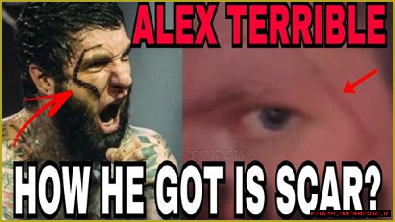 Unveiling The Origin Of Alex Terrible's Scar: Discoveries And Insights